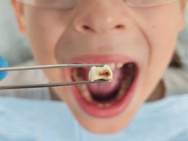 Best Emergency Gum Treatment in Sun Prairie, WI